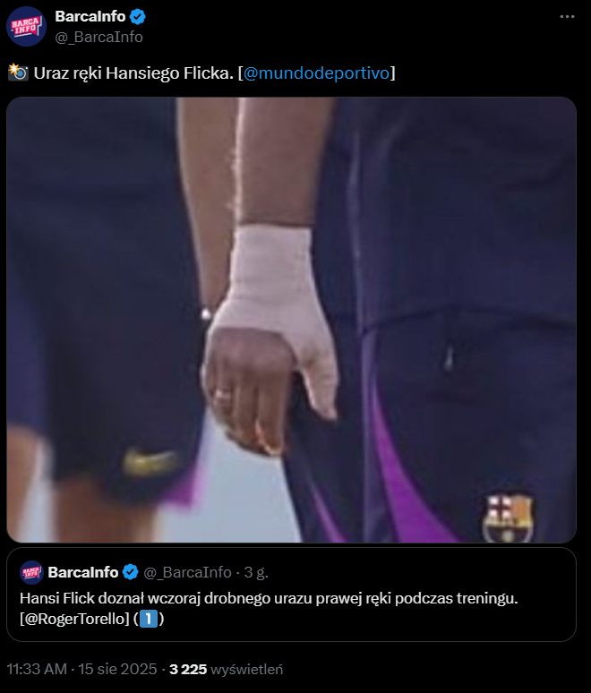 Tak wygląda KONTUZJOWANA DŁOŃ Hansiego Flicka